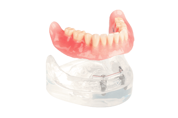 Rx Implant Supported Denture Order Form